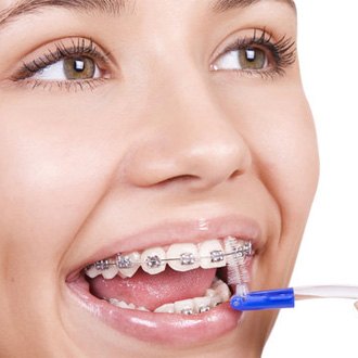 a patient with braces using a dental flosser