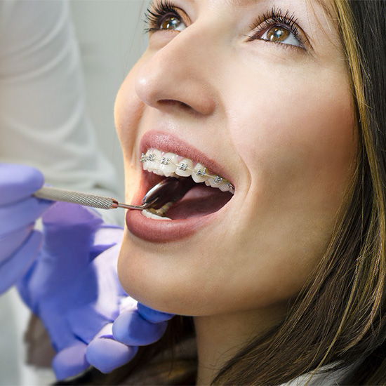 A woman smiling while her orthodontist in Milton examines her braces during orthodontic emergency