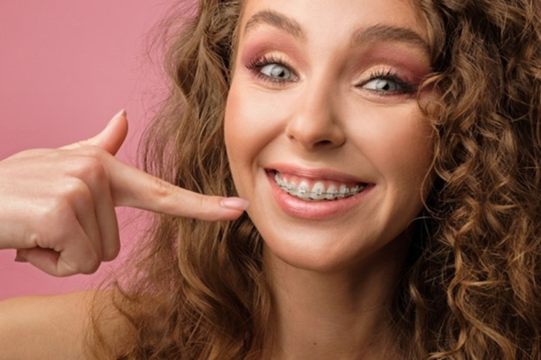Why Do My Teeth Feel Loose With Braces? Milton Orthodontics